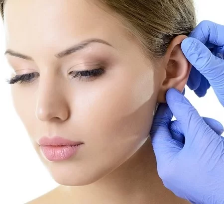 جراحی زیبایی گوش یا اتوپلاستی