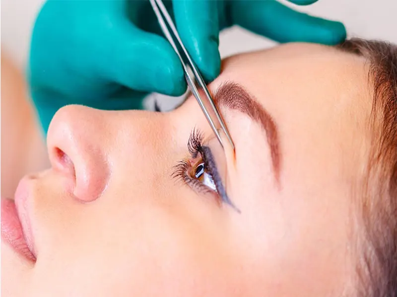 جراحی زیبایی پلک یا بلفاروپلاستی و بررسی آن توسط بهترین جراح زیبایی