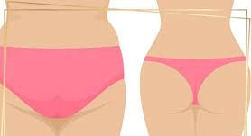 لیپوماتیک باسن توسط بهترین متخصص زیبایی در تهران