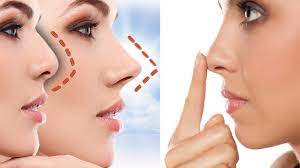 بررسی جراحی بینی غیراستاندارد توسط فوق تخصص جراحی پلاستیک
