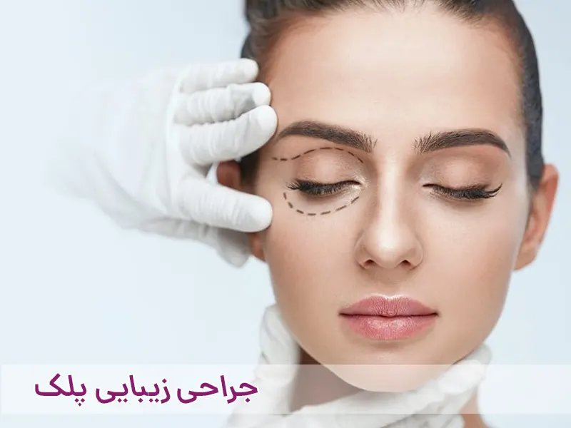 سوالات متداول جراحی پلک یا بلفاروپلاستی