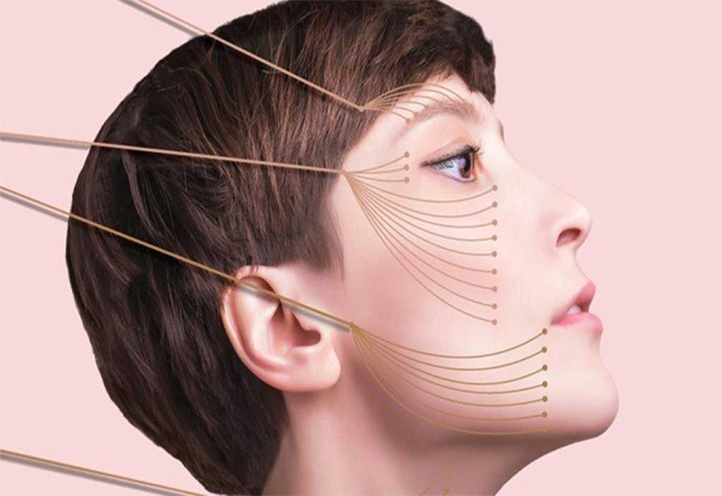 لیفت صورت با نخ از نظر جراح زیبایی در تهران
